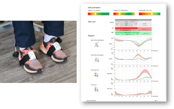Sensors on feet for gait analysis