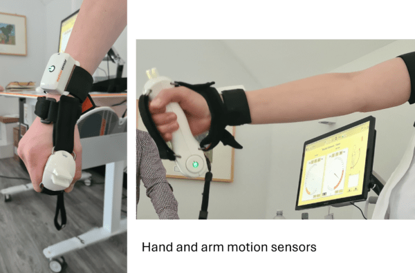 Technology-assisted therapy launched at QEF to intensify impact of neuro rehabilitation 1 hand and arm 1